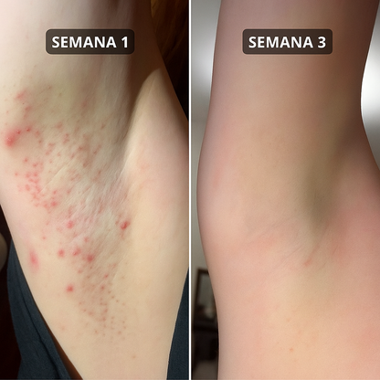 Suavizante Antivellos Encarnados