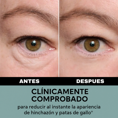 Firmeza Instantatena de Ojos