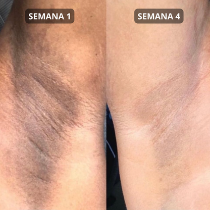 Almohadillas Antimanchas Skincare Coreano