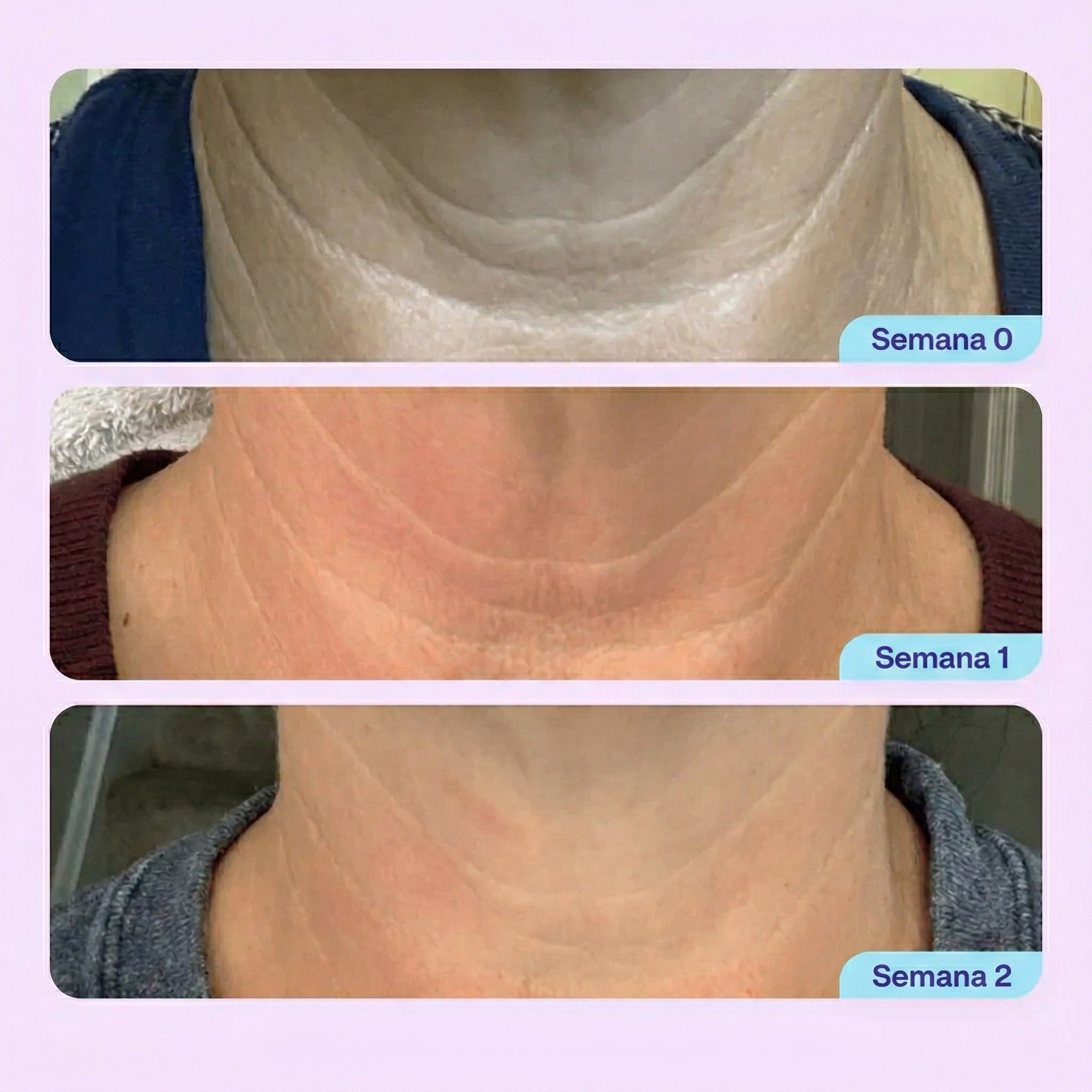 Crema Antiedad para el Cuello